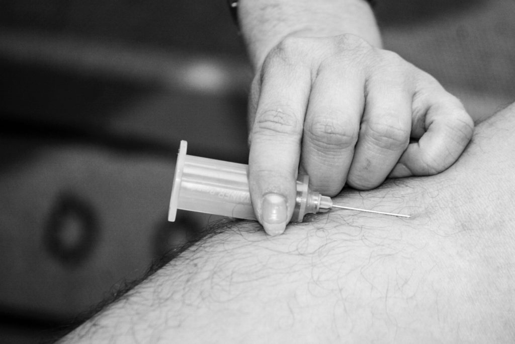 Cortisone injection for back pain